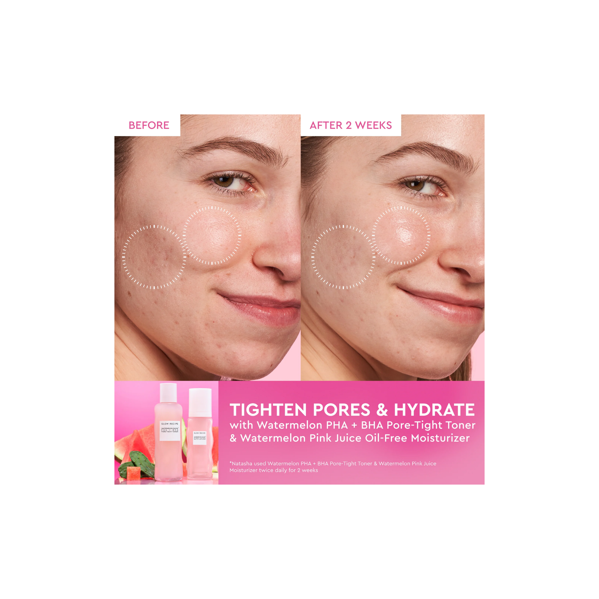 Glow Recipe Watermelon Glow PHA + BHA Pore-tight toner - Image 4